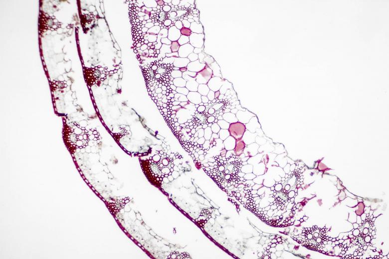 Free stock image of Plant fungus created by Geoffrey Whiteway