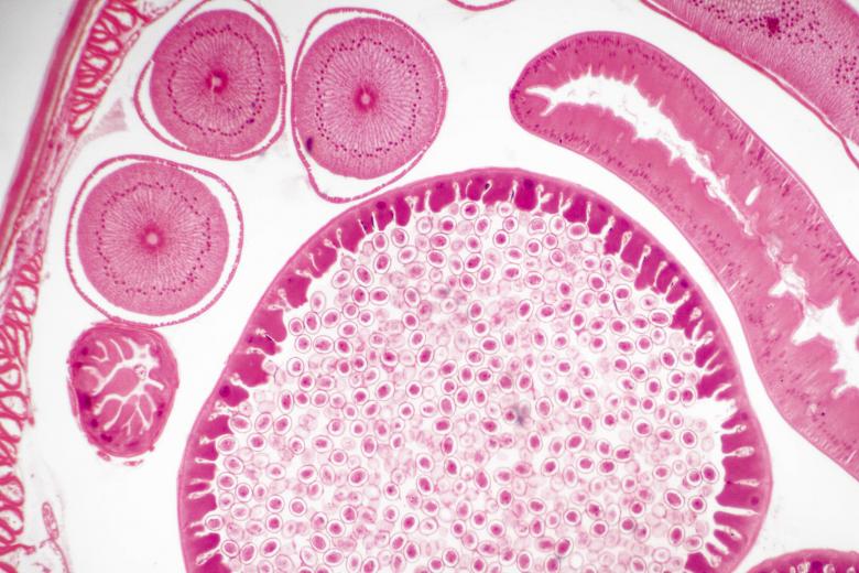 Free stock image of Ascaris Lumbricoides created by Geoffrey Whiteway