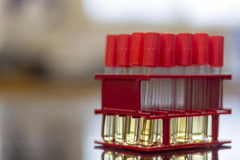Free stock image of Test tubes cantaining media created by Geoffrey Whiteway