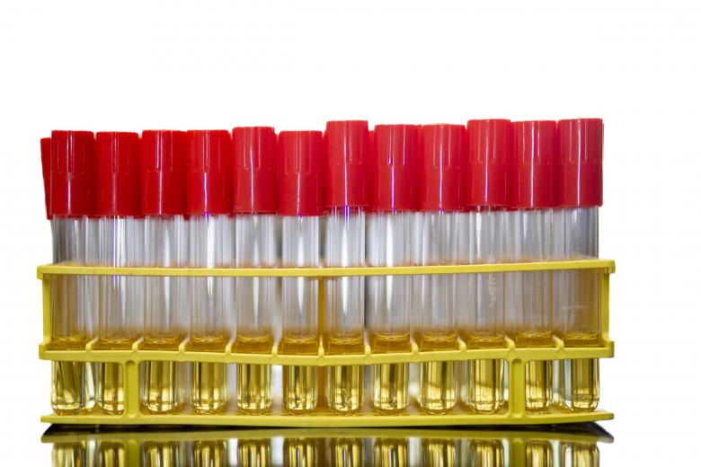 Free stock image of Test tubes containing media created by Geoffrey Whiteway